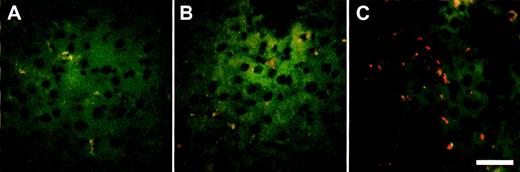 Fig. 6. Localization of IgG fluorescent microspheres in vivo after Ad-mediated FcγRIIA cDNA gene transfer. Sprague Dawley rats received Ad FcγRIIA or AdNull intravenously (109 pfu). After 48 hours, IgG fluorescent microspheres (6 × 1012particles) were injected intravenously, and 1 hour later the livers were removed and frozen section were prepared and analyzed by fluorescence microscopy. (A) Naive control; (B) AdNull-infected; and (C) Ad FcγRIIA-infected. Bar = 50 μm.