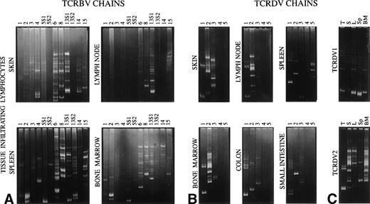 Fig. 6. Heteroduplex analysis of TCRBV (A) and TCRDV (B) chains in lymphocytes infiltrating the indicated tissues. In (C), the amplification products of TCRDV1 and TCRDV2 obtained from different tissues (T, thymus; S, skin; L, lymph node; Sp, spleen; BM, bone marrow) are run in parallel.