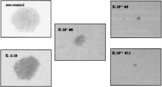 Fig. 3. CD19-expressing KMS-5 cells have lower capacity for colony formation. The indicated clones were plated in soft agar at 5 × 102/mL or 5 × 103/mL in triplicates in 6-well plates and incubated at 37°C and 5% CO2. Two weeks later, the colonies were counted and photographed under a phase contrast microscope.