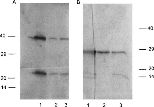 Fig. 2. Western blot pattern for CHEB LC and its mutants. Western blot analysis of LCs produced in vitro by transfected Sp2/0 cells. (A) Nonreduced conditions. Lane 1, CHEB chain; lane 2,CHEBm30; lane 3, CHEBm94. (B) Reduced conditions. Lane 1, CHEB chain; lane 2, CHEBm30; lane 3,CHEBm94. Molecular weight markers are indicated in kilodaltons. The difference in migration of molecular weight markers between (A) and (B) reflects nonreducing versus reducing conditions.
