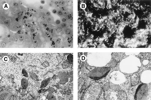 Fig. 3. Mouse CHEB kidney. (A) Light microscopy, toluidine blue staining (original magnification × 500): strong staining of crystalline inclusions in the cytoplasm of proximal tubular cells. (B) Immunofluorescence microscopy, anti-κ human conjugate (original magnification × 500): these inclusions are strongly stained with a pattern similar to that found in patients’ CHEB tubular proximal cells. Electron microscopy: (C) original magnification × 1,200; (D) original magnification × 25,000: these crystalline inclusions are osmiophilic and similar to that found in patient CHEB with the same 60 Å periodic striation.