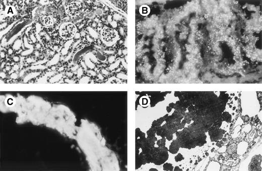 Fig. 6. Mice 269 kidneys. (A) Mouse 269 no. 3, kidney, light microscopy, HES staining (original magnification × 200): glomeruli without abnormalities, tubular casts are large with fracture lines, tubular lumen are enlarged. (B) Mouse 269 no. 8, kidney, immunofluorescence microscopy, antihuman κ conjugate (original magnification × 500): numerous reabsorptive granules in the cytoplasm of proximal tubular cells with a pattern different from that noted in Fig 3 upper right quadrant. (C) Immunofluorescence microscopy, antihuman κ LC conjugate: strong staining of a cast in 1 tubular lumen. Note fracture lines in cast. Tubular basement membranes are unstained. Staining for human λ LC and mouse Igs were negative. (D) Electron microscopy (original magnification × 10,000): osmiophilic myeloma cast without crystalline substructure.