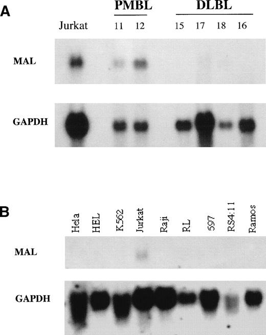 Fig. 2. Northern blot analysis of MAL expression. Fifteen micrograms of total RNAs extracted from PMBLs, peripheral DLBLs, and human cell lines was loaded per lane. Hybond N+ membranes were hybridized with a PCR-derived MAL cDNA fragment (upper panel), stripped, and rehybridized with a GAPDH probe (lower panel) to check the RNA amounts loaded and transferred to the membrane. (A) RNAs from Jurkat T-cell line, 2 PMBLs (no. 11 and 12), and 4 peripheral DLBLs (no. 15, 17, 18, and 16). (B) RNAs from human cell lines. Hela is nonhematopoietic. HEL and K562 are erythroleukemic cell lines. Jurkat is a T-cell line. Raji and Ramos are derived from Burkitt’s lymphoma. RL bears the t(14;18) translocation associated with follicular lymphoma. 697 is a pre-B–cell line and RS 4:11 a pro-B–cell line.