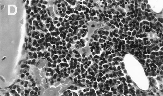 Fig. 3. Human Ig levels (A through C ) and histology of decalcified human bone sections ( D through F ) from SCID-hu hosts inoculated with bone marrow cells ( A and D ), purified plasma cells ( B and E ), and PC-depleted bone marrow cells ( C and F ) from patient no. 2. Inserts demonstrate CD38/CD45 fluorescent profiles and sort windows of cells used for each host.