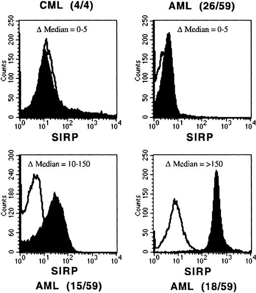 Fig. 5. Reduced SIRP expression on leukemic blasts. Mononuclear BM or PB cells from AML and CML patients were immunolabeled with CD45-FITC and MoAb P3C4 (IgG2a), followed by PE-conjugated goat anti-mouse IgG2a-specific antiserum (filled histogram). Nonbinding IgG2a antibody was used as negative control (black line). The histograms show representative examples of SIRP expression gated on CD45low leukemic blasts. AML samples were divided into 3 groups: no expression (▵median of 0 to 5), reduced expression (▵median of 10 to 150), and normal expression of SIRP (▵median over 150). The number of analyzed samples is given in brackets.