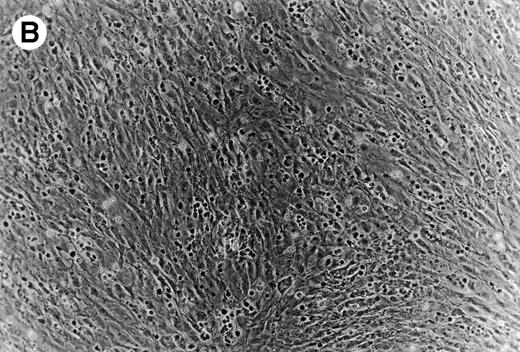 Fig. 6. (A) Representative phase contrast photomicrograph of pseudoemperipolesis of CLL B cells after 2-hour culture on the heterologous murine stromal cell line, M2-10B4. Cells that had not migrated beneath the stromal cells washed off, and the stromal cell layer containing the migrated CLL cells was photographed (200x magnification). Pseudoemperipolesis is characterized by the dark appearance of lymphocytes that have migrated into the same focal plane as the stromal cells. (B) For comparison, this photomicrograph shows reduced pseudoemperipolesis after pretreatment of CLL cells with pertussis toxin.