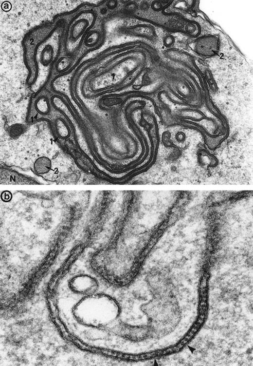 Fig. 3. (a) High magnification of the cell junction between 2 erythroblasts: The electron dense tracer of the extracellular space, tannic acid, decorates the intercellular space. The cytoplasm density of the 2 cells (1 and 2) is unequal, showing that different maturation-stage erythroblasts can be linked together. N, nucleus. Original magnification ×41,400. (b) At a higher magnification, these cell junctions display a septate-like structure (arrowheads). Original magnification ×177,000.
