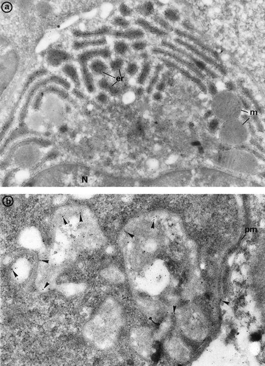 Fig. 7. (a) Bone marrow plasma cells display immunolabeling for the monoclonal gamma chains in the numerous prominent cisternae of endoplasmic reticulum (er) in patient 2. m, mitochondria, N, nucleus. Original magnification ×30,000. (b) Bone marrow immunogold labeling for CD36: Gold particles outline the erythroblast junctions (arrowheads) where immunolabeling is more concentrated compared with the erythroblast plasma membrane (pm) not involved in the junction. Original magnification ×40,000.