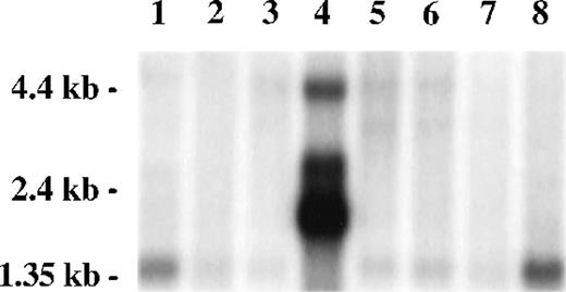 Fig. 3. FAZF is ubiquitously expressed. Multiple human tissue northern blot (Clontech) was probed using radiolabeled restriction fragment from clone 8-1. Lane 1, spleen; lane 2, thymus; lane 3, prostate; lane 4, testis; lane 5, ovary; lane 6, small intestine; lane 7, colon; lane 8, peripheral blood mononuclear leukocyte. Longer exposure of this blot showed a 1.4-kb FAZF band in all tissues except testis.