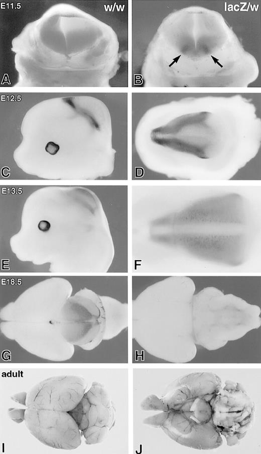 Fig. 5. LacZ staining in the central nervous system of heterozygous (SCLlacZ/w) embryos. (A and B) At E11.5, lacZ staining is apparent in the presumptive motor neurons in the ventral neural tube (arrows). (C) Lateral and (D) dorsal views at E12.5 and (E) lateral and (F) dorsal views at E13.5, showing expression of lacZ in the developing midbrain. At E18.5 (G) and (H) and in the adult mouse (I and J), lacZ expression is strongest in the superior colliculi, but lower levels persist in the inferior colliculi. Weak lacZ expression is evident in tracts on the ventral surface of the hindbrain (H) and (J).
