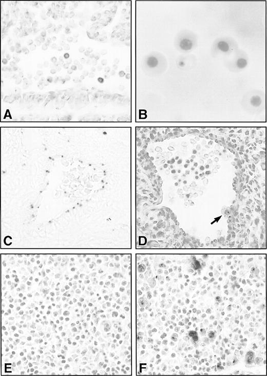 Fig. 6. Histological sections of lacZ-stained hematopoietic and vascular tissues in SCLlacZ/w embryos. (A) Sagittal section through the dorsal aorta of an E9.5 embryo demonstrating lacZ staining of variable intensity in circulating hematopoietic cells. (B) Cytocentrifuge preparation of E13.5 embryonic blood showing lacZ staining in a definitive erythrocyte. (C) Endothelial lacZ expression in a cerebral artery of an E13.5 embryo. (D) The dorsal aorta of an E11.5 embryo demonstrating lacZ staining in the endothelium and in a ventral aortic wall cluster of hematopoietic cells (arrow). All the cells in the cluster were positive, but this cannot be appreciated in a single focal plane. (E) and (F) LacZ staining in E11.5 fetal liver of a wt (E) and heterozygous SCLlacZ/w embryo (F) showing specific staining in large megakaryocytes and smaller erythroblasts. Original magnification: (A, C through F), ×400; (B), ×1,000.