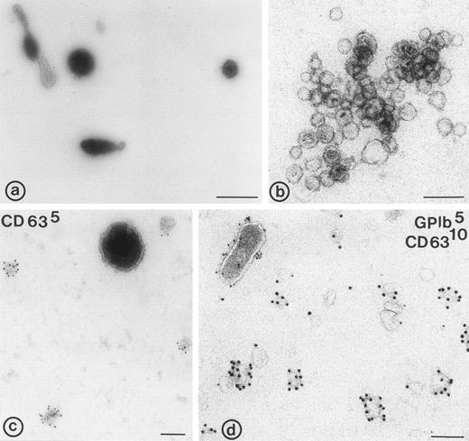 Fig. 2. Electron micrographs of 104-g fraction, and fractions from the sucrose gradient. (a) Plasma membrane-derived microvesicles; (b) exosomes; (c and d) microvesicles and exosomes. (c) Immunolabeling for CD63; note the difference in size between the CD63 positive exosomes and the microvesicle; (d) immuno-double labeling for GPIb and CD63; exosomes are enriched in CD63, while microvesicles (upper left in d) contain predominantly GPIb. Bars: (a) 500 nm; (b through d) 100 nm.