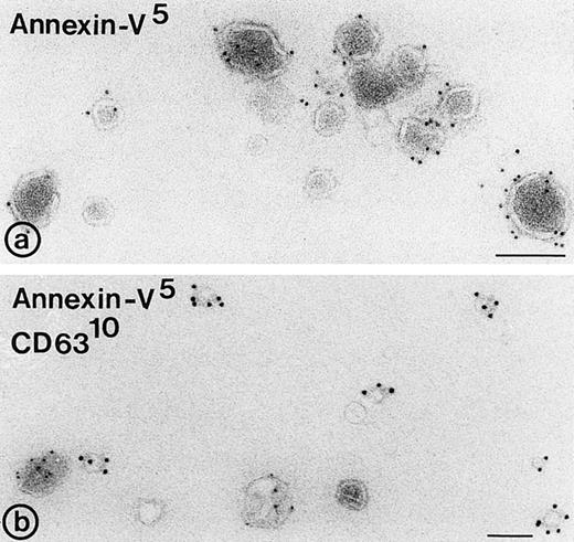 Fig. 4. Binding of annexin-V, prothrombin, and factor X to isolated vesicle fractions. Microvesicles from the 10,000gfraction, exosomes from the sucrose gradient, and PS/PE/PC phopholipids were adsorbed to carbon-coated EM grids. The vesicles were incubated either with FITC-conjugated annexin-V, factor X, or prothrombin in the presence of 5 mmol/L CaCl2. After fixation, the membranes were immunolabeled with their respective antibodies and protein-A gold. (a) Annexin-V binding monitored with a polyclonal anti-FITC antibody and protein-A gold; (b) immunogold double labeling as indicated on the figure. Annexin-V binding is most prominent on the larger microvesicles. (c and d) Binding of prothrombin (c) and factor X (e) to microvesicles, but not to the exosomes (d and f); (g) binding of prothrombin to phospholipid vesicles. Bars: 100 nm.