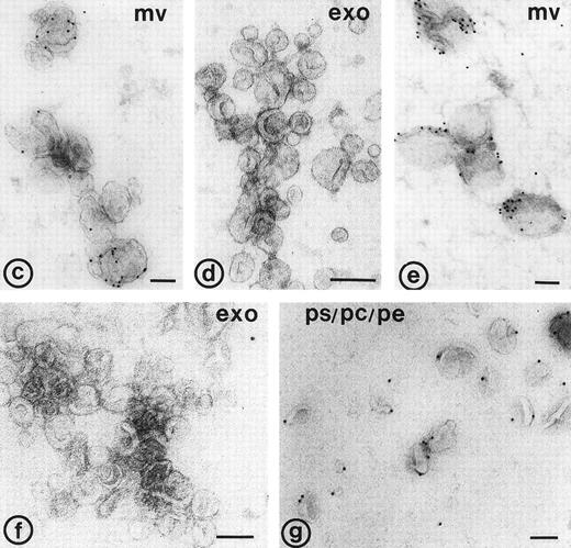 Fig. 4. Binding of annexin-V, prothrombin, and factor X to isolated vesicle fractions. Microvesicles from the 10,000gfraction, exosomes from the sucrose gradient, and PS/PE/PC phopholipids were adsorbed to carbon-coated EM grids. The vesicles were incubated either with FITC-conjugated annexin-V, factor X, or prothrombin in the presence of 5 mmol/L CaCl2. After fixation, the membranes were immunolabeled with their respective antibodies and protein-A gold. (a) Annexin-V binding monitored with a polyclonal anti-FITC antibody and protein-A gold; (b) immunogold double labeling as indicated on the figure. Annexin-V binding is most prominent on the larger microvesicles. (c and d) Binding of prothrombin (c) and factor X (e) to microvesicles, but not to the exosomes (d and f); (g) binding of prothrombin to phospholipid vesicles. Bars: 100 nm.