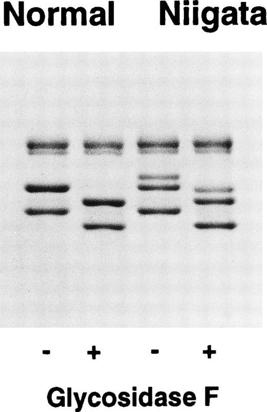 Fig. 6. Removal of N-linked oligosaccharides from Bβ and γ chains of fibrinogen. Fibrinogen (10 mg/mL) was incubated with Glycosidase F (45 U/mL) or without enzymes at 37°C for 24 hours in TBS and then subjected to SDS-PAGE analysis.