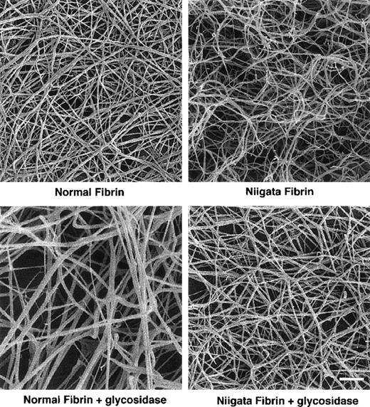 Fig. 7. SEM image of fibrin derived from normal and Niigata and their DG-fibrins. Bar, 10 μm.