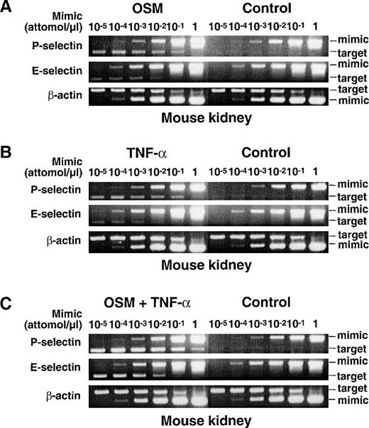 Fig. 5. Intravenous injection of TNF- and OSM cooperatively increases mRNA for P- and E-selectin in murine tissues. Each mouse received an intravenous injection of buffer (Control), or of buffer containing 25 ng murine OSM, 3000 U murine TNF-, or a combination of both cytokines. After 1 hour, the mice were killed and the organs were immediately collected for RNA isolation. The levels of mRNA for P-selectin, E-selectin, and β-actin were measured by a competitive RT-PCR method as in Fig 2, except that the primers contained the respective murine cDNA sequences. Shown is representative agarose gel electrophoresis of the PCR products from mouse kidney. The data are representative of 4 independent experiments for control mice and mice receiving OSM, and 2 independent experiments for mice receiving TNF- or the combination of both cytokines.