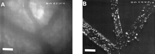 Fig. 2. Sequence of photographs documenting I/R-induced platelet-endothelial cell interactions in vivo. Using IVM, rhodamine-6G–labeled platelets are visualized within 3 postcapillary venules before ischemia (A), as well as following 90 minutes of ischemia and 30 minutes of reperfusion (B). Few platelets adhere to the venular endothelium before I/R (A); the majority passes the vessel segment without interacting with the endothelial surface. In contrast, a large number of platelets are seen interacting with the endothelium 30 minutes after reperfusion (B). Monitor magnification 450×; bars represent 50 μm.