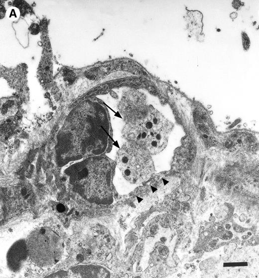 Fig. 3. Platelets in postischemic microvasculature visualized by electron microscopy. There are no defects in the endothelial cell layer (arrowheads) Platelets (arrows) attach directly to endothelial cells (arrowheads). Bars represent 1 μm. Original magnifications: 7,000× (A) and 12,000× (B). NCL, endothelial cell nucleus.