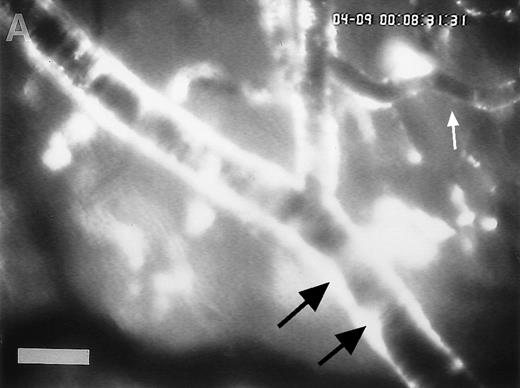 Fig. 4. Accumulation of fibrinogen and platelets during I/R in vivo. Alexa 488-conjugated human fibrinogen (17 mg/kg) was administered intravenously 30 minutes before the induction of ischemia (left column). Rhodamin-labeled platelets were visualized in identical arterioles and venules using a different filter set (right column; see Materials and Methods). In wild-type animals (A,B), fibrinogen is bound unevenly to the vascular wall of arterioles and venules in the postischemic microvasculature. Areas with large amounts of fibrinogen (A, large arrow) can be seen besides regions without detectable fibrinogen deposition (A, small arrow). The accumulation of large amounts of fibrinogen colocalizes with platelet adhesion (B, arrowhead). In mice lacking ICAM-1 (C,D), the I/R-induced accumulation of fibrinogen and platelets is attenuated. Monitor magnification, 450×.