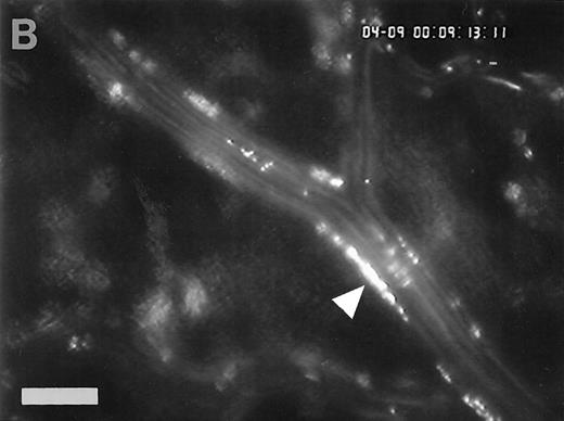 Fig. 4. Accumulation of fibrinogen and platelets during I/R in vivo. Alexa 488-conjugated human fibrinogen (17 mg/kg) was administered intravenously 30 minutes before the induction of ischemia (left column). Rhodamin-labeled platelets were visualized in identical arterioles and venules using a different filter set (right column; see Materials and Methods). In wild-type animals (A,B), fibrinogen is bound unevenly to the vascular wall of arterioles and venules in the postischemic microvasculature. Areas with large amounts of fibrinogen (A, large arrow) can be seen besides regions without detectable fibrinogen deposition (A, small arrow). The accumulation of large amounts of fibrinogen colocalizes with platelet adhesion (B, arrowhead). In mice lacking ICAM-1 (C,D), the I/R-induced accumulation of fibrinogen and platelets is attenuated. Monitor magnification, 450×.