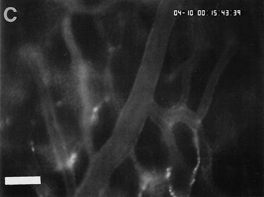 Fig. 4. Accumulation of fibrinogen and platelets during I/R in vivo. Alexa 488-conjugated human fibrinogen (17 mg/kg) was administered intravenously 30 minutes before the induction of ischemia (left column). Rhodamin-labeled platelets were visualized in identical arterioles and venules using a different filter set (right column; see Materials and Methods). In wild-type animals (A,B), fibrinogen is bound unevenly to the vascular wall of arterioles and venules in the postischemic microvasculature. Areas with large amounts of fibrinogen (A, large arrow) can be seen besides regions without detectable fibrinogen deposition (A, small arrow). The accumulation of large amounts of fibrinogen colocalizes with platelet adhesion (B, arrowhead). In mice lacking ICAM-1 (C,D), the I/R-induced accumulation of fibrinogen and platelets is attenuated. Monitor magnification, 450×.