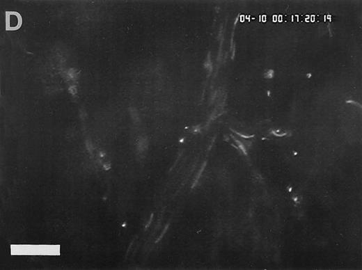Fig. 4. Accumulation of fibrinogen and platelets during I/R in vivo. Alexa 488-conjugated human fibrinogen (17 mg/kg) was administered intravenously 30 minutes before the induction of ischemia (left column). Rhodamin-labeled platelets were visualized in identical arterioles and venules using a different filter set (right column; see Materials and Methods). In wild-type animals (A,B), fibrinogen is bound unevenly to the vascular wall of arterioles and venules in the postischemic microvasculature. Areas with large amounts of fibrinogen (A, large arrow) can be seen besides regions without detectable fibrinogen deposition (A, small arrow). The accumulation of large amounts of fibrinogen colocalizes with platelet adhesion (B, arrowhead). In mice lacking ICAM-1 (C,D), the I/R-induced accumulation of fibrinogen and platelets is attenuated. Monitor magnification, 450×.