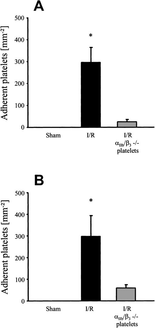 Fig. 5. Adhesion of human platelets in response to 90 minutes of ischemia and subsequent reperfusion. Human platelets derived from healthy human subjects or from a patient suffering from Glanzmann’s disease ( IIb/β3−/−) were labeled with rhodamine-6G and transfused into wild-type mice. Platelet-endothelial cell interactions were investigated in arterioles (A) and venules (B) using IVM. Sham-operated animals served as controls. The number of adherent platelets is given per mm2 vessel surface. Mean ± SEM, n = 6 experimental animals per group. *P < .01v sham, Dunn’s method.