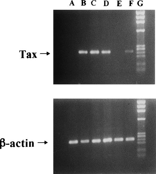 Fig. 1. Induction of Tax mRNA expression in JPX-9 cells by CdCl2. JPX-9 cells were treated with 30 μmol/L of CdCl2 for indicated hours. After incubation, the expression of Tax or β-actin mRNA in the cells was examined by RT-PCR analysis on 1% agarose gel electrophoresis. PCR products for Tax mRNA contain 246-bp fragments, whereas that for β-actin mRNA contains 236-bp fragments. Primer pairs used are 5′-AAACAGCCCTGCAGATACAAAGT-3′ (upper primer) and 5′-ACTGTAGAGCTGAGCCGATAACG-3′ (lower primer) for Tax, and 5′-GACGAGGCCCAGAGCAAGAGAG-3′ (upper primer) and 5′-ACGTACATGGCTGGGGTGTTG-3′ (lower primer) for β-actin. Lane A; CdCl2-untreated JPX-9 cells. Lane B; JPX-9 cells treated with CdCl2 for 3 hours. Lane C; JPX-9 cells treated with CdCl2 for 6 hours. Lane D; JPX-9 cells treated with CdCl2 for 12 hours. Lane E; Jurkat cells (negative control). Lane F; MT-2 cells (positive control). Lane G; DNA size marker (Hind III digests of λ DNA).
