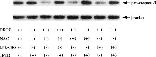 Fig. 6. Suppression of the activation of caspase-3 by caspase-8 inhibitor in JPX-9 cells during apoptotic process induced by NF-κB inhibitors. CdCl2-untreated JPX-9 cells were cultured with or without NF-κB inhibitors (PDTC, NAC, or LLL-CHO) in the presence or absence of caspase-8 inhibitor Z-IETD-FMK for 24 hours. After incubation, the expression of pro-caspase-3 was determined as described in the text. Note that the decrease of pro-caspase-3 expression, which indicates caspase-3 activation, in JPX-9 cells induced by NF-κB inhibitors is almost recovered by the addition of Z-IETD-FMK. Results are representative examples of 4 similar experiments.