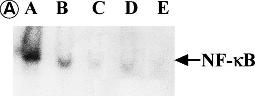 Fig. 8. Nuclear NF-κB activity determined by EMSA. Nuclear proteins of JPX-9 cells treated with (B; CdCl2 treatment for 6 hours) or without CdCl2 (A) in the presence or absence of NF-κB inhibitors, was incubated with radiolabeled oligonucleotide containing NF-κB binding site, and nuclear NF-κB activity was examined by EMSA as described in the text. (A) Nuclear NF-κB activity in CdCl2-untreated JPX-9 cells. Lane A; positive control (MT-2 cells). Lane B; CdCl2-untreated JPX-9 cells without NF-κB inhibitors. Lane C; CdCl2-untreated JPX-9 cells, and then cultured in 50 μmol/L of PDTC for 3 hours. Lane D; CdCl2-untreated JPX-9 cells, and then cultured in 50 mmol/L of NAC for 3 hours. Lane E; CdCl2-untreated JPX-9 cells, and then cultured in 10 μmol/L of LLL-CHO for 3 hours. Note that basal nuclear NF-κB activity in CdCl2-untreated JPX-9 cells was clearly suppressed by 3 kinds of NF-κB inhibitors. (B) Nuclear NF-κB activity in CdCl2-treated JPX-9 cells. Lane A; control (CdCl2-untreated JPX-9 cells without NF-κB inhibitors). Lane B; CdCl2-treated JPX-9 cells (without NF-κB inhibitors). Lane C; CdCl2-treated JPX-9 cells, and then cultured in 50 μmol/L of PDTC for 3 hours. Lane D; CdCl2-treated JPX-9 cells, and then cultured in 50 mmol/L of NAC for 3 hours. Lane E; CdCl2-treated JPX-9 cells, and then cultured in 10 μmol/L of LLL-CHO for 3 hours. Lane F; CdCl2-treated JPX-9 cells, and then cultured for 3 hours without NF-κB inhibitors. Note that nuclear NF-κB in JPX-9 cells was clearly augmented by CdCl2 treatment, and its activity is still high in the presence of 3 kinds of NF-κB inhibitors. (C) Nuclear NF-κB activity of Jurkat cells was not augmented by incubation of the cells with CdCl2. Lane A; Jurkat cells without CdCl2 treatment. Lane B; Jurkat cells treated with CdCl2 for 6 hours. Results (Fig 8A through C) are representative of 5 experiments.
