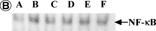 Fig. 8. Nuclear NF-κB activity determined by EMSA. Nuclear proteins of JPX-9 cells treated with (B; CdCl2 treatment for 6 hours) or without CdCl2 (A) in the presence or absence of NF-κB inhibitors, was incubated with radiolabeled oligonucleotide containing NF-κB binding site, and nuclear NF-κB activity was examined by EMSA as described in the text. (A) Nuclear NF-κB activity in CdCl2-untreated JPX-9 cells. Lane A; positive control (MT-2 cells). Lane B; CdCl2-untreated JPX-9 cells without NF-κB inhibitors. Lane C; CdCl2-untreated JPX-9 cells, and then cultured in 50 μmol/L of PDTC for 3 hours. Lane D; CdCl2-untreated JPX-9 cells, and then cultured in 50 mmol/L of NAC for 3 hours. Lane E; CdCl2-untreated JPX-9 cells, and then cultured in 10 μmol/L of LLL-CHO for 3 hours. Note that basal nuclear NF-κB activity in CdCl2-untreated JPX-9 cells was clearly suppressed by 3 kinds of NF-κB inhibitors. (B) Nuclear NF-κB activity in CdCl2-treated JPX-9 cells. Lane A; control (CdCl2-untreated JPX-9 cells without NF-κB inhibitors). Lane B; CdCl2-treated JPX-9 cells (without NF-κB inhibitors). Lane C; CdCl2-treated JPX-9 cells, and then cultured in 50 μmol/L of PDTC for 3 hours. Lane D; CdCl2-treated JPX-9 cells, and then cultured in 50 mmol/L of NAC for 3 hours. Lane E; CdCl2-treated JPX-9 cells, and then cultured in 10 μmol/L of LLL-CHO for 3 hours. Lane F; CdCl2-treated JPX-9 cells, and then cultured for 3 hours without NF-κB inhibitors. Note that nuclear NF-κB in JPX-9 cells was clearly augmented by CdCl2 treatment, and its activity is still high in the presence of 3 kinds of NF-κB inhibitors. (C) Nuclear NF-κB activity of Jurkat cells was not augmented by incubation of the cells with CdCl2. Lane A; Jurkat cells without CdCl2 treatment. Lane B; Jurkat cells treated with CdCl2 for 6 hours. Results (Fig 8A through C) are representative of 5 experiments.