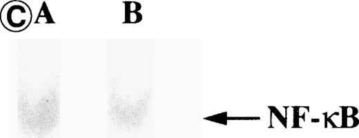 Fig. 8. Nuclear NF-κB activity determined by EMSA. Nuclear proteins of JPX-9 cells treated with (B; CdCl2 treatment for 6 hours) or without CdCl2 (A) in the presence or absence of NF-κB inhibitors, was incubated with radiolabeled oligonucleotide containing NF-κB binding site, and nuclear NF-κB activity was examined by EMSA as described in the text. (A) Nuclear NF-κB activity in CdCl2-untreated JPX-9 cells. Lane A; positive control (MT-2 cells). Lane B; CdCl2-untreated JPX-9 cells without NF-κB inhibitors. Lane C; CdCl2-untreated JPX-9 cells, and then cultured in 50 μmol/L of PDTC for 3 hours. Lane D; CdCl2-untreated JPX-9 cells, and then cultured in 50 mmol/L of NAC for 3 hours. Lane E; CdCl2-untreated JPX-9 cells, and then cultured in 10 μmol/L of LLL-CHO for 3 hours. Note that basal nuclear NF-κB activity in CdCl2-untreated JPX-9 cells was clearly suppressed by 3 kinds of NF-κB inhibitors. (B) Nuclear NF-κB activity in CdCl2-treated JPX-9 cells. Lane A; control (CdCl2-untreated JPX-9 cells without NF-κB inhibitors). Lane B; CdCl2-treated JPX-9 cells (without NF-κB inhibitors). Lane C; CdCl2-treated JPX-9 cells, and then cultured in 50 μmol/L of PDTC for 3 hours. Lane D; CdCl2-treated JPX-9 cells, and then cultured in 50 mmol/L of NAC for 3 hours. Lane E; CdCl2-treated JPX-9 cells, and then cultured in 10 μmol/L of LLL-CHO for 3 hours. Lane F; CdCl2-treated JPX-9 cells, and then cultured for 3 hours without NF-κB inhibitors. Note that nuclear NF-κB in JPX-9 cells was clearly augmented by CdCl2 treatment, and its activity is still high in the presence of 3 kinds of NF-κB inhibitors. (C) Nuclear NF-κB activity of Jurkat cells was not augmented by incubation of the cells with CdCl2. Lane A; Jurkat cells without CdCl2 treatment. Lane B; Jurkat cells treated with CdCl2 for 6 hours. Results (Fig 8A through C) are representative of 5 experiments.