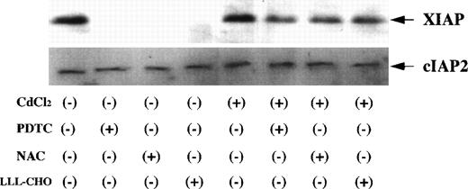 Fig. 11. Expression of XIAP and cIAP2 in JPX-9 cells. JPX-9 cells were preincubated with or without CdCl2 for 6 hours, washed with PBS, and further incubated with or without PDTC (50 μmol/L), NAC (50 mmol/L), or LLL-CHO (10 μmol/L) for 24 hours. After incubation, the expression of XIAP and cIAP2 was examined as described in the text. Note that XIAP expression in CdCl2-untreated JPX-9 cells is almost suppressed by NF-κB inhibitors, however, its expression in CdCl2-treated JPX-9 cells is maintained even in the presence of NF-κB inhibitors. In contrast, cIAP2 expression in JPX-9 cells was not changed in each culture condition. Results are representative examples of 4 similar experiments.