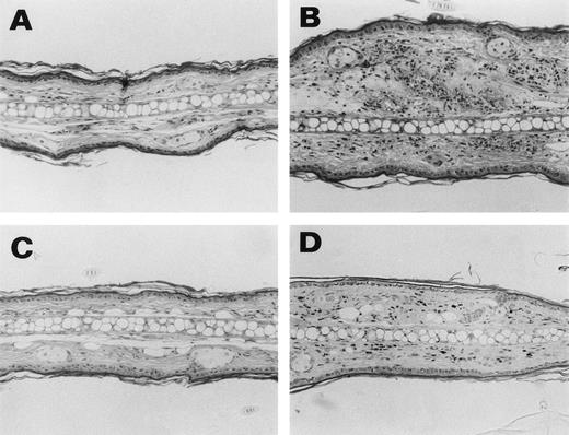 Fig. 2. Representative histological appearance of 6-19–induced skin lesions. The sections of the ear from untreated normal mice (A) and 6-19–treated FcRγ+/− (B), FcRγ−/− (C), and TNFβ−/− (D) mice were prepared 12 days after IP injection of 6-19 hybridoma cells. Tissues sections were stained with HE (original magnification × 100). FcRγ+/− mice developed leukocytoclastic vasculitis characterized by the infiltration of PMNs and the extravasation of erythrocytes (B). FcRγ−/− and TNF−/− mice did not develop leukocytoclastic vascular lesions (C and D). Note that in (D), darkly stained cells were melanocytes due to 129 background and that small numbers of PMNs had infiltrated the skin of TNF−/− mice.