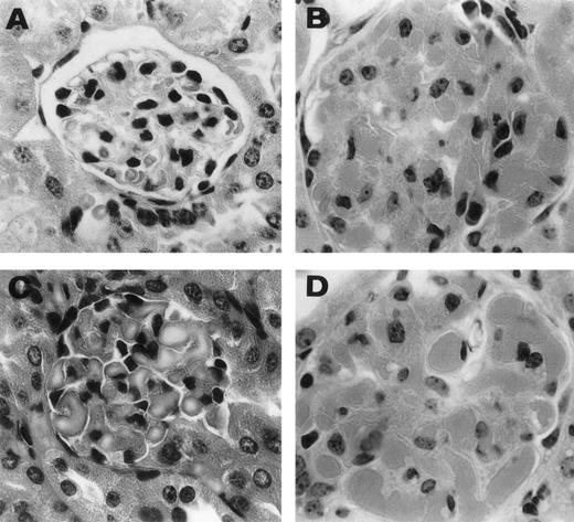 Fig. 4. Representative histological appearance of 6-19–induced glomerular lesions. The sections of the ear from untreated normal mice (A) and 6-19–treated FcRγ+/− (B), FcRγ−/− (C), and TNFβ−/− (D) mice were prepared 12 days after the IP injection of 6-19 hybridoma cells. Tissues sections were stained with HE (original magnification × 400). 6-19–treated FcRγ+/− mice developed glomerulonephritis with global proliferative and exudative changes (B). FcRγ−/− and TNF−/− mice developed similar glomerular lesions (C and D).