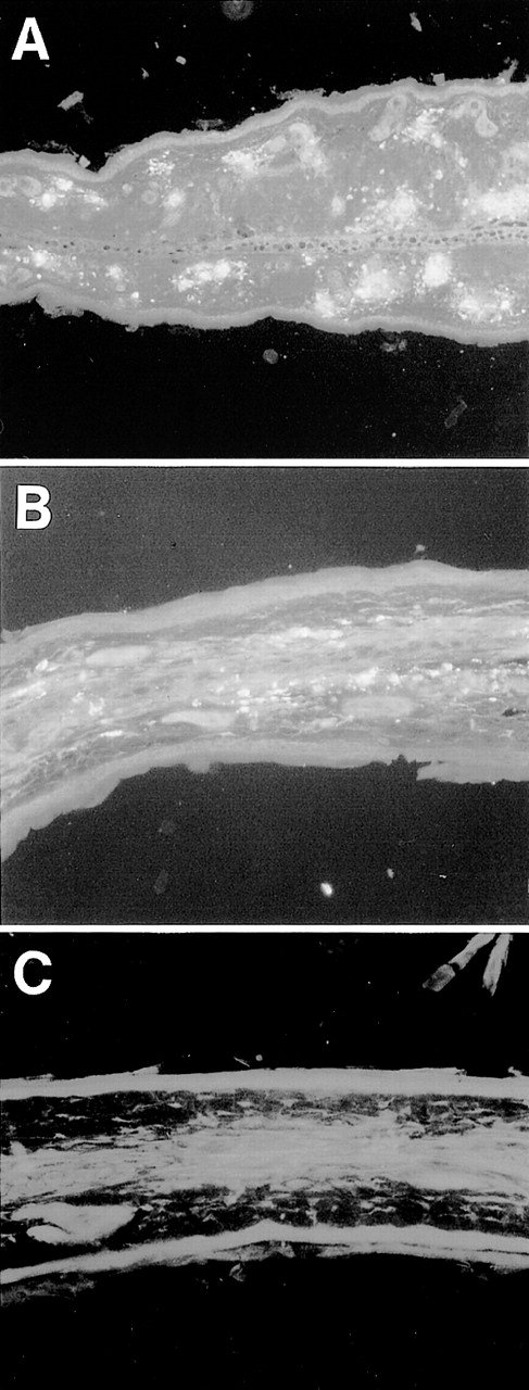 Fig. 3. Deposition of IgG3 RF on the vessel wall of ear skin. Ear sections from 6-19–treated FcRγ+/− (A) and FcRγ−/− (B) mice and nontreated FcRγ+/−mice (C) were stained with FITC–anti-IgG3 Ab (original magnification × 200).