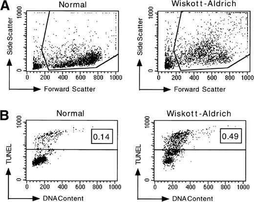 Fig. 1. Analysis of apoptotic lymphocytes isolated from WAS patients. The levels of apoptosis were measured using TUNEL immediately after isolation or after incubation in vitro. PBL were not stimulated. (A) WAS lymphocytes had increased side scatter and decreased forward scatter, characteristics of apoptosis, after 4 days of incubation in vitro relative to normal lymphocytes. (B) Representative data acquired after TUNEL indicate that a higher fraction of WAS lymphocytes were undergoing apoptosis relative to normal, healthy donor lymphocytes after 4 days of incubation in vitro. The fraction of TUNEL-positive cells is indicated in the upper right corner. (C) WAS lymphocytes underwent apoptosis at a greater frequency than normal lymphocytes. Levels of apoptosis were measured immediately after isolation of PBL from WAS patients or from normal individuals using the TUNEL assay. N, the mean value for a group of 8 different normal controls (3 children and 5 adults). W, the mean value for a group of 5 different WAS patients. 1 through 5, the mean values for each individual WAS patient. Patient no. 5 was analyzed twice in 2 independent experiments (with 6 and 3 replicates); all other patients were analyzed once in single experiments (with 6 replicates). An unbalanced repeated measures analysis of variance (ANOVA) showed that the values for patients no. 2, 3, 4, and 5 differed significantly from the mean normal value (P ≤ .0001). The mean value for the group of 5 WAS patients (W) also differed significantly from the mean normal (P = .0123). n, the number of different samples; *, statistical significance. (D) WAS lymphocytes were more susceptible to apoptosis than normal lymphocytes after in vitro incubations of 24, 48, and 96 hours. Considerable variability in the apoptotic susceptibility of PBL from different WAS patients was apparent. Mean levels of apoptosis are reported in Table 1. Patient no. 1 was analyzed once in a single experiment, patient no. 2 was analyzed 3 times in 3 independent experiments, and patients no. 3, 4, and 5 were analyzed twice in 2 independent experiments. Results from 8 different normal controls (3 children and 5 adults) are shown. The number of repeated measures made in each experiment was varied, ranging from 2 to 6 (generally 4), depending on the number of PBL isolated from the blood samples. An unbalanced repeated measures ANOVA showed that differences between the groups, WAS and normal, are significant at 24, 48, and 96 hours (P = .000181, .00283, and .000190, respectively). *Statistical significance.