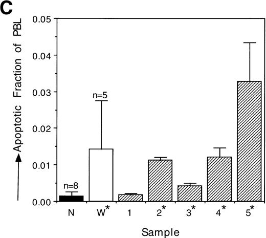 Fig. 1. Analysis of apoptotic lymphocytes isolated from WAS patients. The levels of apoptosis were measured using TUNEL immediately after isolation or after incubation in vitro. PBL were not stimulated. (A) WAS lymphocytes had increased side scatter and decreased forward scatter, characteristics of apoptosis, after 4 days of incubation in vitro relative to normal lymphocytes. (B) Representative data acquired after TUNEL indicate that a higher fraction of WAS lymphocytes were undergoing apoptosis relative to normal, healthy donor lymphocytes after 4 days of incubation in vitro. The fraction of TUNEL-positive cells is indicated in the upper right corner. (C) WAS lymphocytes underwent apoptosis at a greater frequency than normal lymphocytes. Levels of apoptosis were measured immediately after isolation of PBL from WAS patients or from normal individuals using the TUNEL assay. N, the mean value for a group of 8 different normal controls (3 children and 5 adults). W, the mean value for a group of 5 different WAS patients. 1 through 5, the mean values for each individual WAS patient. Patient no. 5 was analyzed twice in 2 independent experiments (with 6 and 3 replicates); all other patients were analyzed once in single experiments (with 6 replicates). An unbalanced repeated measures analysis of variance (ANOVA) showed that the values for patients no. 2, 3, 4, and 5 differed significantly from the mean normal value (P ≤ .0001). The mean value for the group of 5 WAS patients (W) also differed significantly from the mean normal (P = .0123). n, the number of different samples; *, statistical significance. (D) WAS lymphocytes were more susceptible to apoptosis than normal lymphocytes after in vitro incubations of 24, 48, and 96 hours. Considerable variability in the apoptotic susceptibility of PBL from different WAS patients was apparent. Mean levels of apoptosis are reported in Table 1. Patient no. 1 was analyzed once in a single experiment, patient no. 2 was analyzed 3 times in 3 independent experiments, and patients no. 3, 4, and 5 were analyzed twice in 2 independent experiments. Results from 8 different normal controls (3 children and 5 adults) are shown. The number of repeated measures made in each experiment was varied, ranging from 2 to 6 (generally 4), depending on the number of PBL isolated from the blood samples. An unbalanced repeated measures ANOVA showed that differences between the groups, WAS and normal, are significant at 24, 48, and 96 hours (P = .000181, .00283, and .000190, respectively). *Statistical significance.