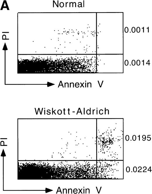 Fig. 2. Annexin V staining confirmed that WAS lymphocytes underwent apoptosis at a greater frequency than normal lymphocytes. Representative data indicate that a higher percentage of WAS lymphocytes had externalized phosphatidylserine and bound annexin V compared with normal lymphocytes. Furthermore, a higher percentage of lymphocytes from WAS patients were inviable, no longer excluding PI, relative to lymphocytes from normal individuals. Apoptotic cells are represented by events in the lower right-hand quadrant, with viable and dead cells depicted by events in the lower left-hand and upper right-hand quadrants, respectively. The fraction of cells undergoing apoptosis and the fraction of dead cells are indicated at the right of each plot. (B) Both methods of analysis, annexin V staining and TUNEL, indicated that WAS lymphocytes underwent apoptosis at a greater frequency than normal lymphocytes. Samples from 4 different WAS patients (no. 1 through 4) and 6 different normal controls were analyzed. Statistical analysis by an unbalanced repeated measures ANOVA showed that the differences between WAS and normal levels of apoptosis as measured using annexin V were significant after in vitro incubations of 48 and 96 hours, as indicated by the asterisks (P = .0013 and .0181, respectively). TUNEL data (shown in Fig 1) is duplicated for easy comparison.