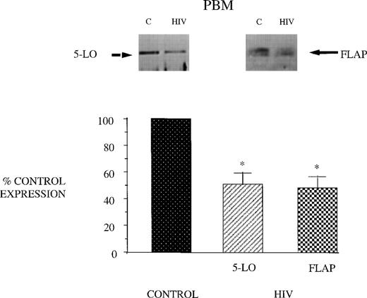 Fig. 2. 5-LO and FLAP expression in PBM from control and AIDS subjects. Equal amounts (20 μg of protein) of crude cellular lysate from PBM were subjected to immunoblot analysis for 5-LO and FLAP as described in Materials and Methods. Top panel, representative autoradiograph of a Western blot demonstrating the amount of 5-LO (left) and FLAP (right) in PBM from healthy control and HIV-infected subjects. Lower panel, relative expression of 5-LO and FLAP in PBM from healthy control and HIV-infected subjects, as assessed by densitometry and expressed as a percent of values derived from cells from healthy control subjects. Data represent the mean ± SEM from n = 8 subjects. *P < .001.