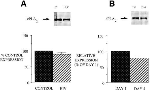 Fig. 3. cPLA2 expression in PBM from healthy control and AIDS subjects and after GM-CSF therapy of AIDS patients. Equal amounts (20 μg of protein) of crude cellular lysate from PBM were subjected to immunoblot analysis for 5-LO and FLAP as described in Materials and Methods. Top panel, a representative Western blot and lower panel, mean densitometric data. (A) cPLA2 expression in PBM from healthy control and HIV-infected subjects expressed as a percent of values obtained from healthy control subjects. (B) cPLA2 expression in PBM from HIV-infected subjects treated with GM-CSF therapy, as assessed by densitometry and expressed as a percent of values derived from day 1 PBM. n = 9, P = not significant (NS).