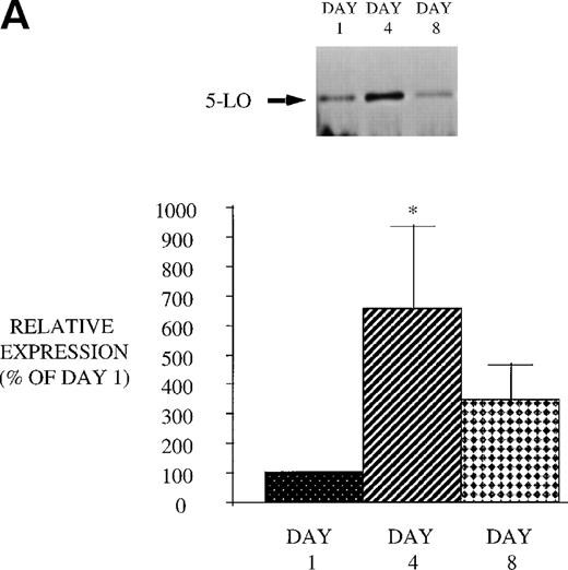 Fig. 9. Effect of in vivo GM-CSF therapy on PMN 5-LO and FLAP expression in AIDS subjects. PMN were isolated on day 1, day 4, and day 8 of the study protocol, as described in Materials and Methods. Equal amounts (20 μg of protein) of crude cellular lysate from PMN were subjected to immunoblot analysis for 5-LO and FLAP. Top panel, representative autoradiograph of a Western blot demonstrating the amount of 5-LO (A) and FLAP (B) in PMN from HIV-infected subjects on protocol day 1, 4, and 8. Lower panel, relative expression of 5-LO (A) and FLAP (B) in PMN from HIV-infected subjects treated with GM-CSF, as assessed by densitometry and expressed as a percent of values derived from day 1 PMN. n = 9, * P = .05.