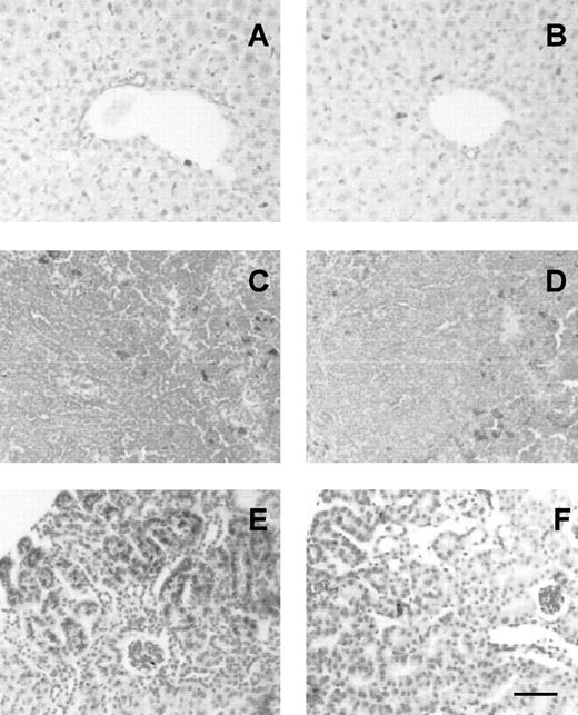 Fig. 4. Iron loading in Hx −/− tissues. Liver (A,B), spleen (C,D) and kidney (E,F) sections from Hx −/− (A,C,E) and wild-type (B,D,F) mice stained with Prussian blue for detection of ferric iron. Liver and spleen show iron deposits in Kupffer cells and macrophages, respectively, without differences between knockouts and controls. Kidney of Hx −/− has much more iron loading compared with controls: intense blue staining is evident in proximal cortical tubules. Bar, 20 μm.