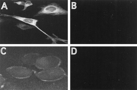 Fig. 2. Immunostaining of HFE. HtTA-HFE cells were grown on coverslips for 4 days in the absence (A,C) or presence (B,D) of 1 μg/mL doxycycline. Immunostaining was perfromed as described in the methods. Permeabilzed cells were incubated with the antiserum directed against the C-terminal peptide (A,B), unpermeabilized cells were incubated with the antiserum directed against the N-terminal peptide (C,D).