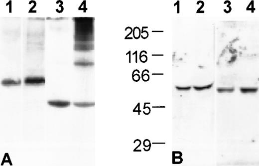 Fig. 1. Noncovalent polymers of antitrypsin and, to a much lesser extent, antithrombin, are present in S/D plasma. Western blot analysis of plasma proteins. (A) Nondenaturing-PAGE and (B) SDS-PAGE with molecular weight standards as indicated: (1) antithrombin in FFP; (2) antithrombin in S/D plasma; (3) antitrypsin in FFP; (4) antitrypsin in S/D plasma.