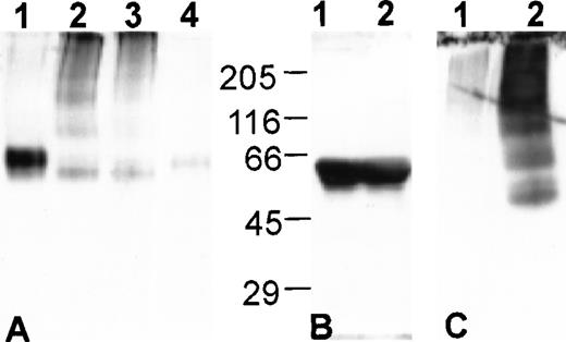 Fig. 2. The latent and polymerized conformations of antiplasmin are present in S/D plasma. Western blot analysis of plasma proteins. (A) Nondenaturing-PAGE: (1) antiplasmin in FFP; (2) antiplasmin in FFP following S/D treatment in our laboratory (see Materials and Methods); (3) antiplasmin in S/D plasma; (4) antiplasmin in FFP diluted 10-fold more than lane 1. (B) SDS-PAGE with molecular weight standards as indicated: (1) antiplasmin in FFP; (2) antiplasmin in S/D plasma. (C) Nondenaturing-PAGE of S/D plasma containing aggregates: (1) antiplasmin in S/D plasma after removal of aggregates; (2) antiplasmin in aggregates isolated as described in Materials and Methods.