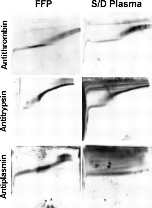 Fig. 3. Conformational stability of antithrombin, antitrypsin, and antiplasmin in FFP and S/D plasma. Analysis is performed by TUG-PAGE. Each panel represents Western blot analysis of plasma proteins separated on a single gel with the direction of migration from top to bottom and the urea gradient (0 to 8 mol/L) from left to right.