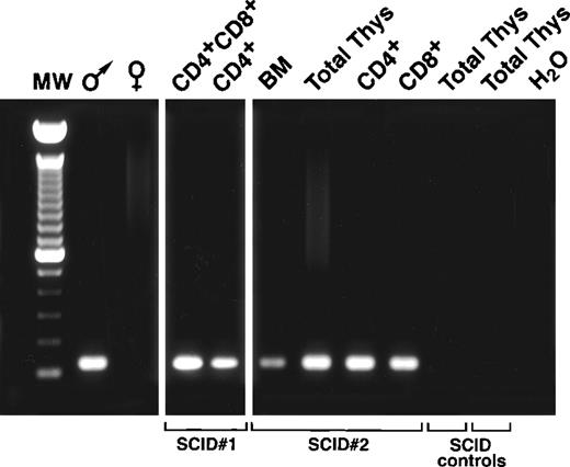 Fig. 4. Detection of CB-derived thymocytes in the thymic grafts of CB/Thy-NOD/SCID mice. CB/Thy-NOD/SCID chimeras were generated by BM reconstitution with male human CB followed by transplantation of female thymi. Control Thy-NOD/SCID received human female thymi only. At 6 months post-CB reconstitution, the CD4/CD8 double and single-positive thymic subsets were purified by cell sorting. DNA was extracted and assessed for the presence of Y chromosome–specific sequences by PCR. The resulting products resolved on a 1.2% agarose gel are shown. A strong band with the predicted size of 150 bp is detected in the BM, total thymocytes (Total Thys), as well as double and single-positive thymic subsets of CB/Thy-NOD/SCID mice (SCID no. 1 and no. 2), indicating the colonization of the grafts by BM-derived thymocyte progenitors of CB origin. DNA from total thymocytes of Thy-NOD/SCID mice (SCID controls) is negative. Each lane corresponds to the analysis of 10,000 cells. Control PCR using DNA extracted from male (♂) and female (♀) CB cells are shown on the left. The far left lane represents a 100-bp DNA ladder. The lane on the far right shows a control using Y chromosome–specific primers and no template DNA.