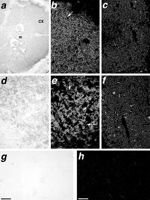 Fig. 3. Histological analysis of thymic transplants. Cryostat sections from thymic grafts of CB/Thy-NOD/SCID mice (a, b, c, g, and h) and control Thy-NOD/SCID mice (d through f) stained by a peroxidase detection method with an anti-human CD45 MoAb (a and d, dark brown color), by 2-color immunofluorescence with an anti-human CD45 MoAb (b and e, green fluorescence), and an anti-mouse MHC class I MoAb (b and e, red fluorescence) or by a TUNEL assay and propidium iodide (c and f, green and red fluorescence, respectively). (g and h) Background staining of isotype control antibodies for the immunohistochemistry and immunofluorescence techniques, respectively. The preservation of cortical and medullary regions (a, cx, and m) in the grafts of CB/Thy-NOD/SCID mice contrast with the perturbed tissue architecture of the grafts from control Thy-NOD/SCID mice (d). Clusters of mouse cells (e, arrows) and numerous apoptotic cells organized in rosette-like clusters (f) can be frequently observed in the grafts of Thy-NOD/SCID mice. In contrast, rare mouse cells (b, arrow) and sparse apoptotic events are observed in the grafts of CB/Thy-NOD/SCID mice (c). Bar in a, d, and g, 254 μm; Bar in b, c, e, and h, 63.5 μm.